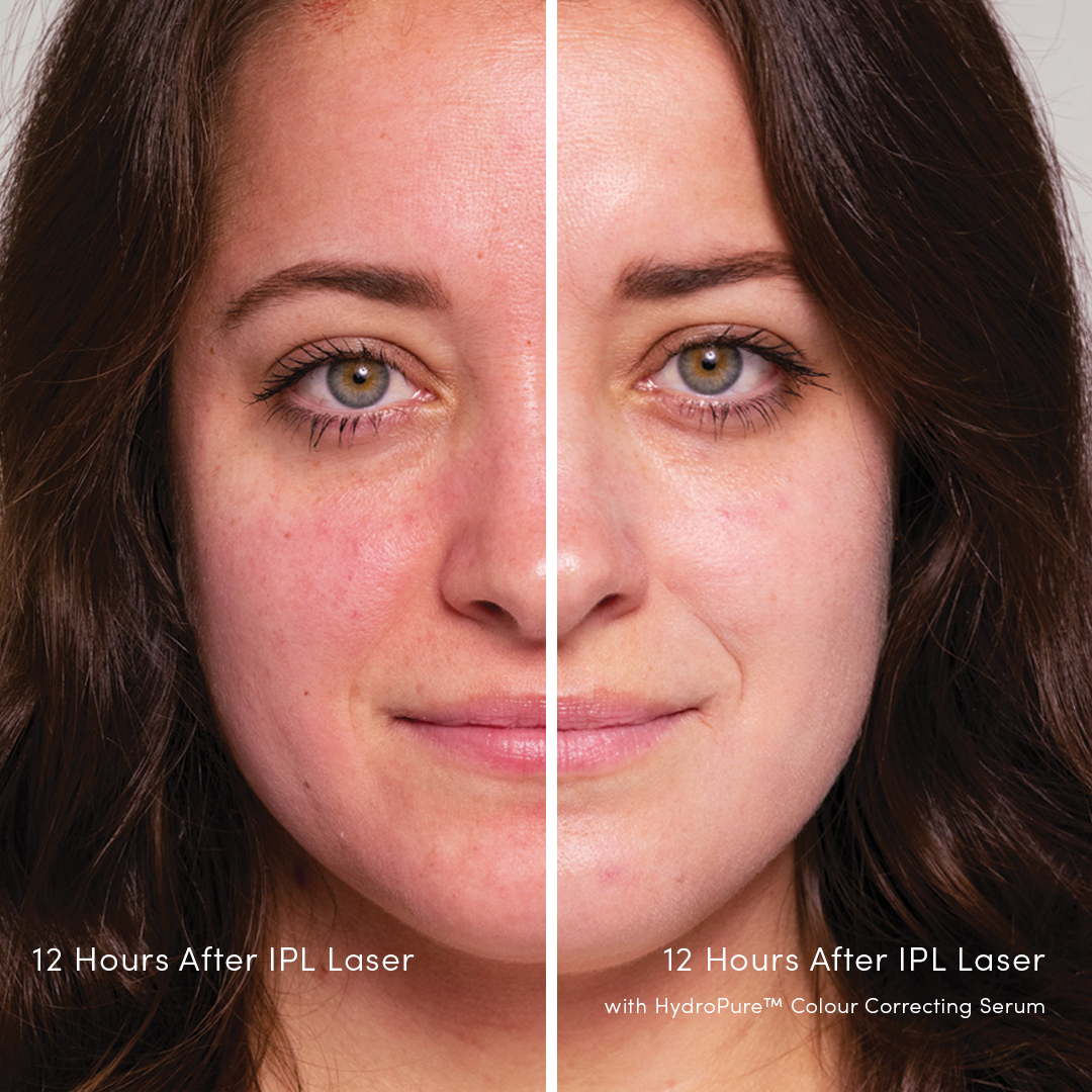 HydroPure Colour Correcting Serum