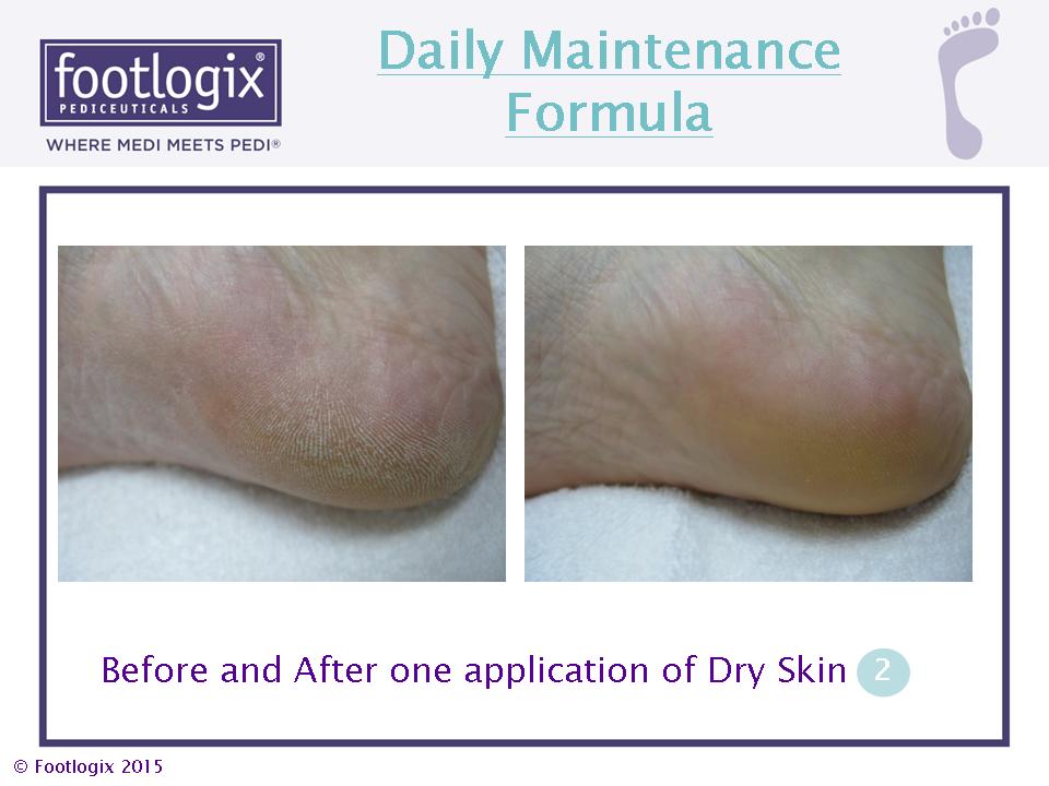 Daily Maintenance Formula