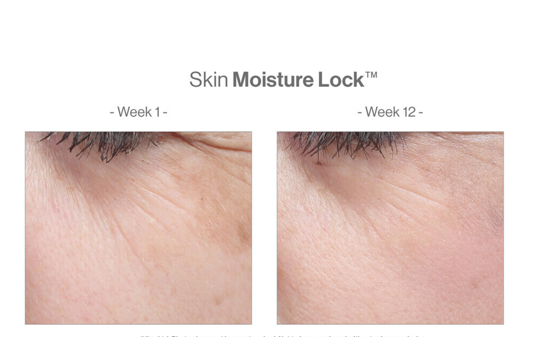 Skin Moisture Lock